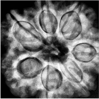 Real 7-Mukhi X-Ray Locule Density Analysis